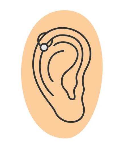 双侧耳软骨隆鼻的优势是什么？(图1)