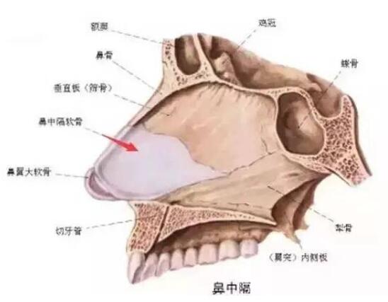 耳软骨、肋软骨、鼻中隔，用它们隆鼻有啥区别？(图3)