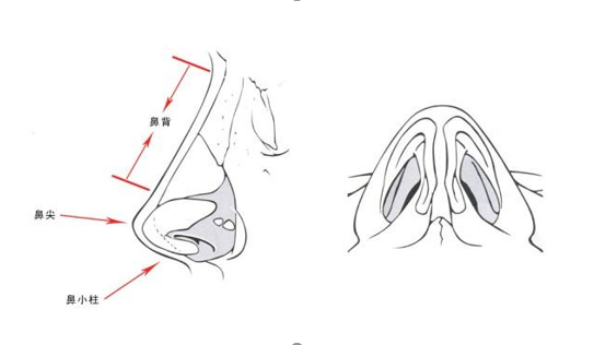 常见的隆鼻方式有哪些?一个鼻子漂亮的秘密(图1)